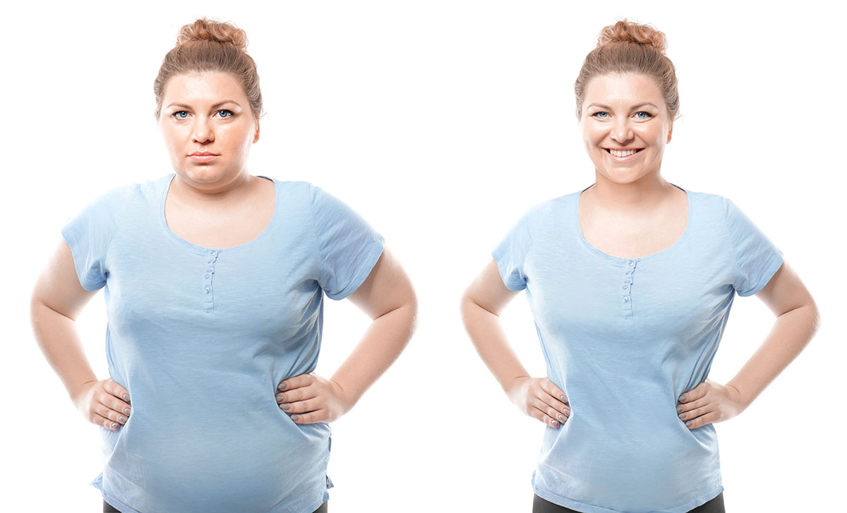 Obezite ve Diyabet Cerrahisi Nedir – Kimler İçin Uygundur?