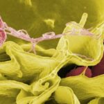 ABD’de salmonella salgını 27 eyalete yayıldı