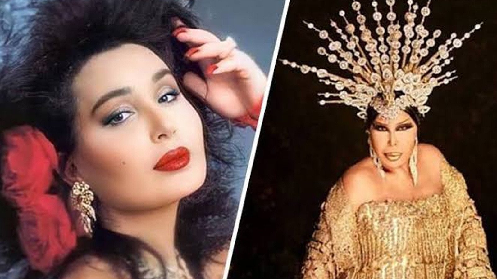 Bülent Ersoy’un estetik sonrası son hali gündem oldu: Diva’dan yeni paylaşım geldi