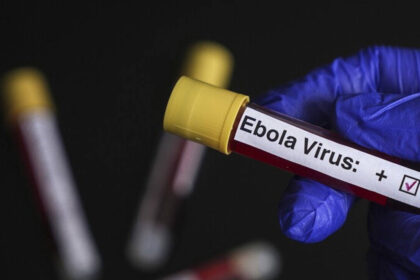 İsrail’de ilk kez görüldü: Bir kişi Ebola şüphesiyle karantinaya alındı